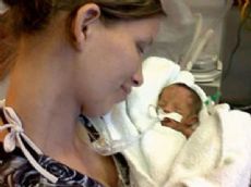 La beba contin�a con asistencia respiratoria mec�nica con par�metros en descenso.