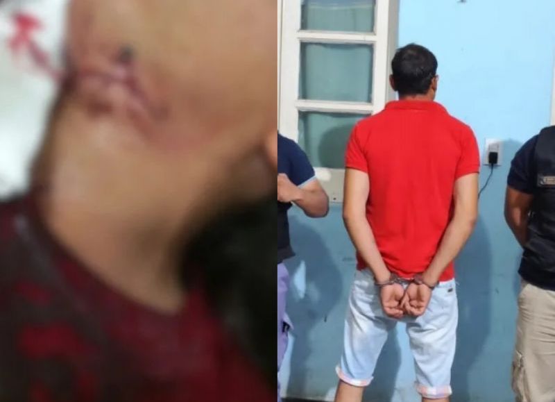 Detuvieron a un hombre que le cortó el cuello a su expareja en Taco Pozo