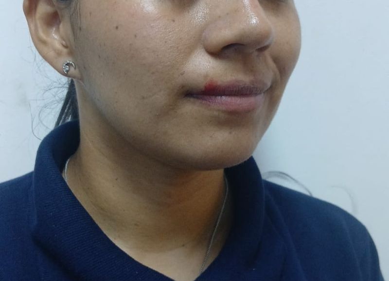 Machagai: detuvieron a un hombre tras agredir a su pareja y atacar a policías que acudieron al auxilio